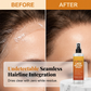 🥳PROMOÇÃO DE 2026🥳💞Mais de 50 mil unidades vendidas!🧡✨Spray de fixação extrema para rendas